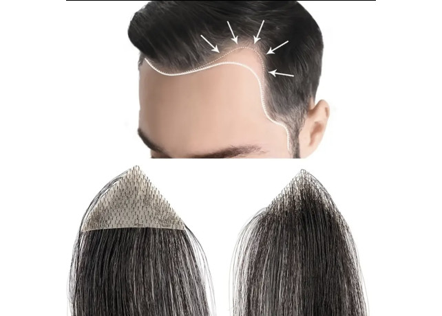 Mesa Adeziva pentru Alopecie